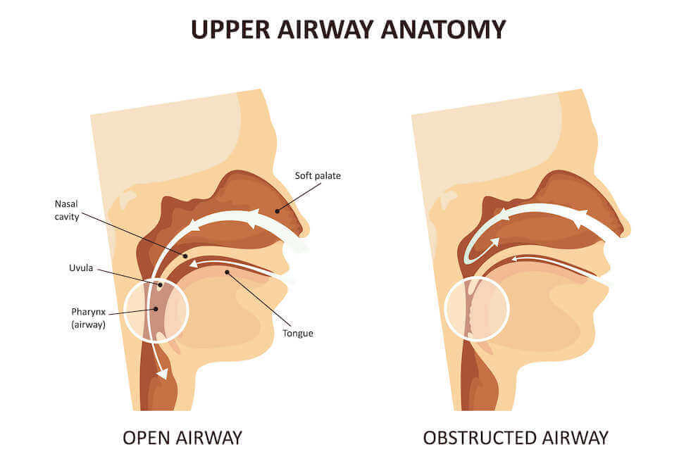 Upper airway anatomy diagram